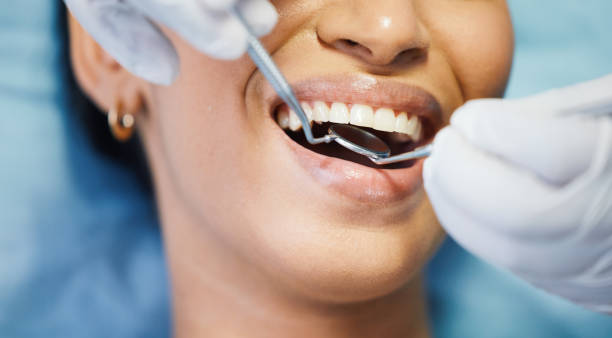 Best Walk-In Emergency Dental Services in Weston, FL